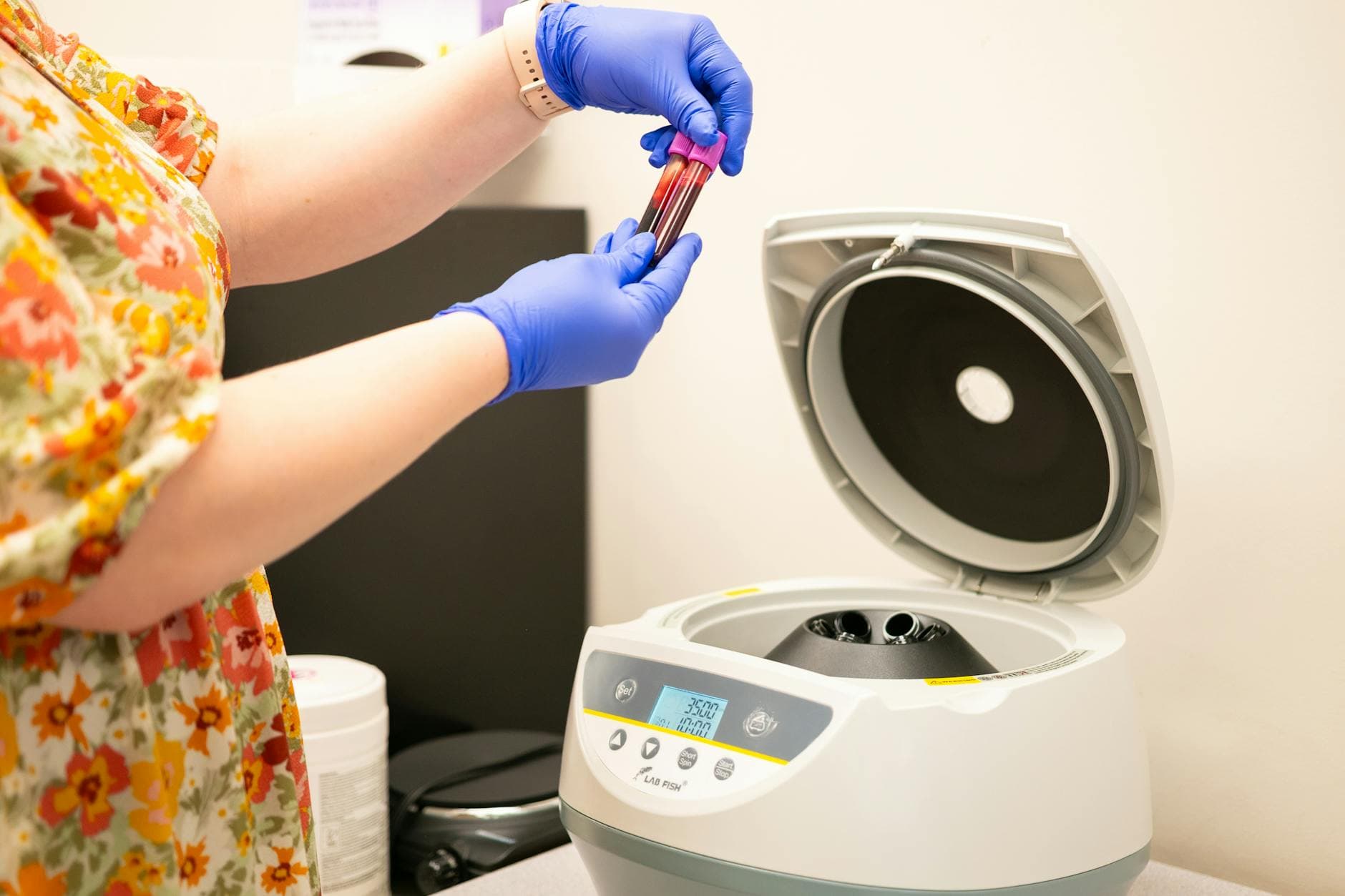 PRP (Platelet-Rich Plasma)